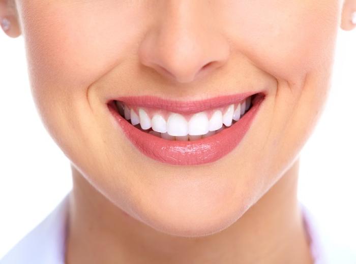 Dental Bonding Benefits for a Perfect Smile