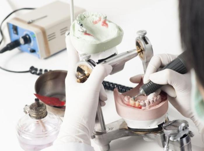 Dental Crown Process Explained