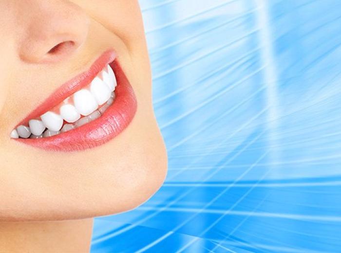 Teeth Whitening: Questions to Ask for a Dazzling Smile in Jenkintown