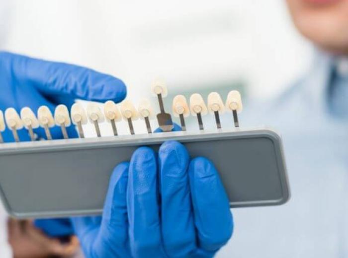 Choosing the Right Dental Implant Restoration Option for Your Needs