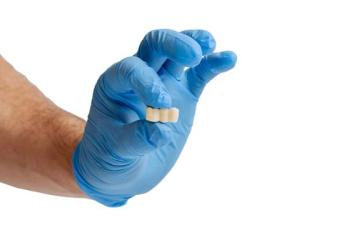 Are There Different Types of Dental Bridges?