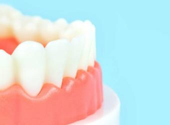 Your Path to Healthier Gums: Understanding Pocket Reduction Surgery