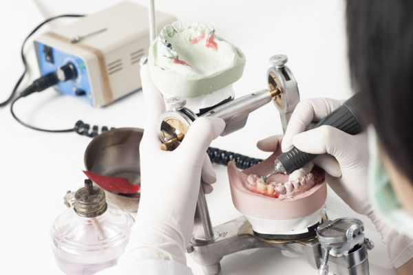 What To Know About The Dental Crown Process