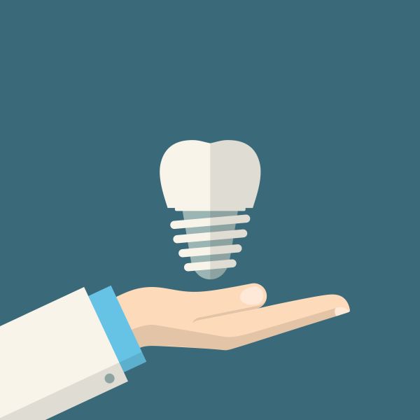Who Should Perform Dental Implant Placement?
