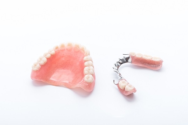 What You Should Know About Implant Supported Dentures