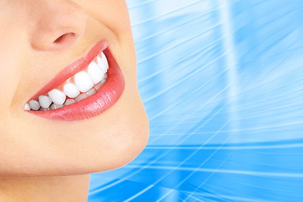 Questions To Ask If You Are Considering Teeth Whitening 